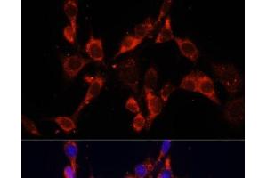 Immunofluorescence analysis of NIH/3T3 cells using DVL2 Polyclonal Antibody at dilution of 1:100. (DVL2 anticorps)