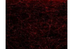 Immunohistochemistry (IHC) image for anti-ELK3, ETS-Domain Protein (SRF Accessory Protein 2) (ELK3) (AA 189-204) antibody (ABIN1742519)