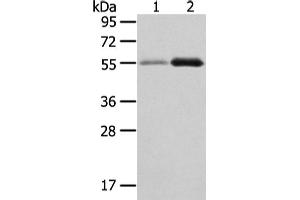 Western Blotting (WB) image for anti-XK, Kell Blood Group Complex Subunit-Related Family, Member 3 (XKR3) antibody (ABIN5962449) (XKR3 anticorps)