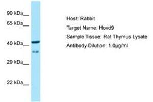 Image no. 1 for anti-Homeobox D9 (HOXD9) (N-Term) antibody (ABIN6749851) (HOXD9 anticorps  (N-Term))