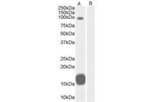 Image no. 1 for anti-rho GTPase Activating Protein 26 (ARHGAP26) (C-Term) antibody (ABIN374371) (GRAF anticorps  (C-Term))
