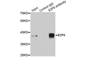 Immunoprecipitation analysis of 200ug extracts of MCF-7 cells using 3ug E2F6 antibody. (E2F6 anticorps)