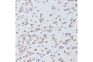 Immunohistochemistry of paraffin-embedded mouse brain using TNFRSF11A antibody. (TNFRSF11A anticorps)