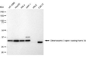 Western blotting analysis using Chromosome 3 open reading frame 38 antibody (ABIN7798079). (Recombinant C3orf38 anticorps)