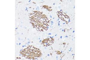 Immunohistochemistry of paraffin-embedded rat brain using APP Rabbit mAb (ABIN7265575) at dilution of 1:100 (40x lens). (APP anticorps)