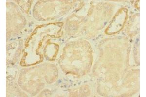 Immunohistochemistry of paraffin-embedded human kidney tissue using ABIN7166755 at dilution of 1:100 (DHX32 anticorps  (AA 301-500))