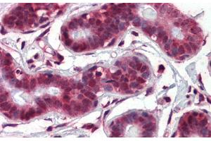 Immunohistochemistry with Human Breast tissue at an Antibody concentration of 5.
