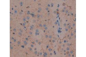Used in DAB staining on fromalin fixed paraffin- embedded brain tissue (DLG5 anticorps  (AA 1724-1917))