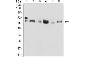Western blot analysis using CK5 mouse mAb against A431 (1), MCF-7 (2), SK-Br-3 (3), Hela (4), Lncap (5), and HepG2 (6) cell lysate.