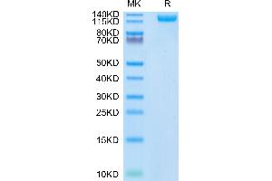 SARS-CoV-2 Spike S1 (N501Y) protein (His tag)