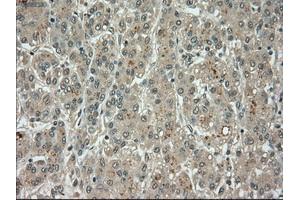 Image no. 10 for anti-Budding Uninhibited By Benzimidazoles 1 Homolog beta (Yeast) (BUB1B) antibody (ABIN1497000) (BUB1B anticorps)