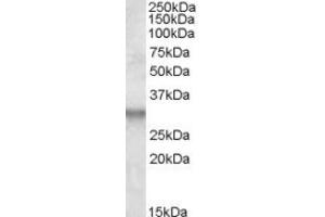Image no. 1 for anti-Integral Membrane Protein 2B (ITM2B) (Internal Region) antibody (ABIN375095) (ITM2B anticorps  (Internal Region))