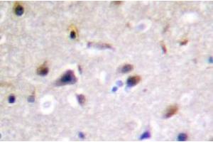 Image no. 2 for anti-Dystrophin Related Protein 2 (DRP2) antibody (ABIN317802) (DRP2 anticorps)
