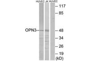 Western blot analysis of extracts from HuvEc/Jurkat cells, using OPN3 Antibody. (OPN3 anticorps  (AA 161-210))