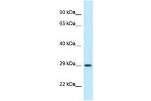 Image no. 1 for anti-Oligodendrocyte Transcription Factor 1 (OLIG1) (AA 96-145) antibody (ABIN6747872) (OLIG1 anticorps  (AA 96-145))