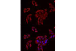 Immunofluorescence analysis of U2OS cells using P2RX4 antibody. (P2RX4 anticorps)