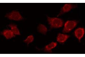 ABIN6267388 staining Hela by IF/ICC. (ATF2 anticorps  (pSer94, pSer112))