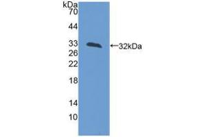 Western blot analysis of recombinant Rat LCT. (LCT anticorps  (AA 33-291))