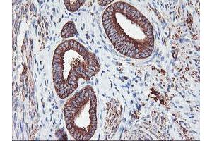 Image no. 5 for anti-phosphofructokinase, Platelet (PFKP) antibody (ABIN1500161)