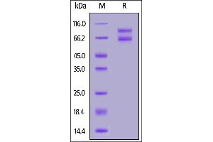 Biotinylated Human IL-2RB&IL-2RG Heterodimer Protein, Fc,Avitag&Fc,Avitag on  under reducing (R) condition. (IL-2 R beta & IL-2 R gamma (AA 27-239) (Active) protein (Fc Tag,AVI tag,Biotin))