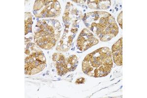 Immunohistochemistry of paraffin-embedded human stomach using BMPR2 antibody (ABIN7265906) at dilution of 1:100 (40x lens).