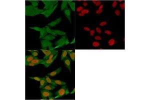 IF/ICC testing of fixed and permeabilized human HeLa cells with FSP1 antibody (clone S100A4/1481, green) and Reddot nuclear stain (red). (s100a4 anticorps)
