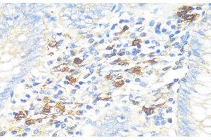 Immunohistochemistry of paraffin-embedded Human appendix using TPSAB1 Polyclonal Antibody at dilution of 1:100 (40x lens). (TPSAB1 anticorps)