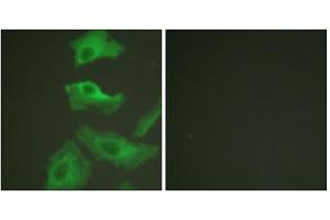 Immunofluorescence analysis of HeLa cells, treated with TNF-a (20nM, 15mins), using HSP90B (epitope around residue 254) antibody (ABIN5976154). (HSP90AB1 anticorps  (Ser254))