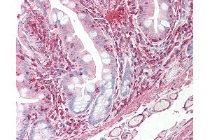 Anti-VEGFC antibody IHC staining of human small intestine.