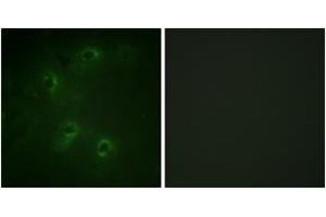 Immunofluorescence analysis of COS7 cells, using DAPK1 (Ab-308) Antibody. (DAP Kinase 1 anticorps  (AA 274-323))