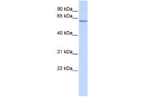 WB Suggested Anti-TRIM16 Antibody Titration:  0. (TRIM16 anticorps  (N-Term))