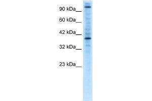 WB Suggested Anti-ZNF624 Antibody Titration:  0. (ZNF624 anticorps  (Middle Region))