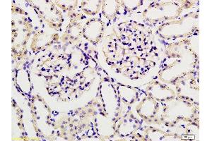 Formalin-fixed and paraffin embedded rat kidney tissue labeled with Rabbit Anti-Podoplanin/gp36 Polyclonal Antibody , Unconjugated 1:200 followed by conjugation to the secondary antibody and DAB staining (Podoplanin anticorps  (AA 91-166))