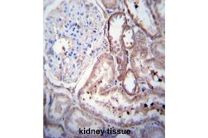 Immunohistochemistry (IHC) image for anti-Platelet Derived Growth Factor D (PDGFD) antibody (ABIN3002574) (PDGFD anticorps)