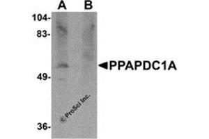 Western Blotting (WB) image for anti-Phosphatidic Acid Phosphatase Type 2 Domain Containing 1A (PPAPDC1A) (C-Term) antibody (ABIN1030596) (PPAPDC1A anticorps  (C-Term))