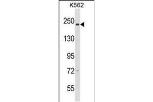 Western blot analysis in K562 cell line lysates (35ug/lane). (NCAPD3 anticorps  (C-Term))