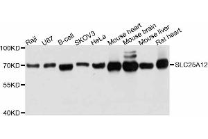 Western blot analysis of extracts of various cell lines, using SLC25A12 antibody (ABIN4905188) at 1:3000 dilution. (SLC25A12 anticorps)