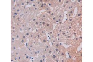 Used in DAB staining on fromalin fixed paraffin- embedded liver tissue