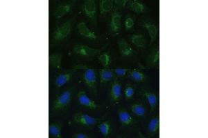 Immunofluorescence analysis of U-2 OS cells using SULT1C4 antibody (ABIN7270631) at dilution of 1:100.