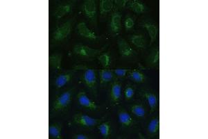 Immunofluorescence analysis of U-2 OS cells using SULT1C4 antibody (ABIN7270631) at dilution of 1:100. (SULT1C4 anticorps  (AA 1-95))