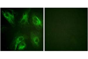 anti-Kv Channel Interacting Protein 3, Calsenilin (KCNIP3) (AA 29-78), (pSer63) antibody