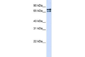 WB Suggested Anti-SF1 Antibody Titration:  0. (Splicing Factor 1 anticorps  (N-Term))
