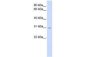WB Suggested Anti-ZNF501 Antibody Titration:  0. (ZNF501 anticorps  (C-Term))