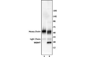 MGMT antibody (pAb) tested by Immunoprecipitation.
