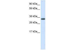 WB Suggested Anti-ERCC8 Antibody Titration:  0. (ERCC8 anticorps  (N-Term))