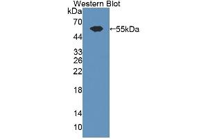 Western blot analysis of the recombinant protein. (ADAMTS13 anticorps  (AA 896-1131))