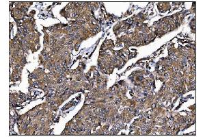 IHC analysis of POGLUT1 using anti-POGLUT1 antibody (ABIN7602910). (POGLUT1 anticorps  (C-Term))