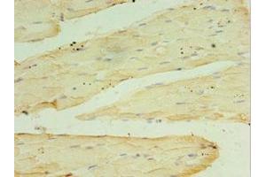 Immunohistochemistry of paraffin-embedded human skeletal muscle tissue using ABIN7166948 at dilution of 1:100 (RPH3AL anticorps  (AA 161-315))