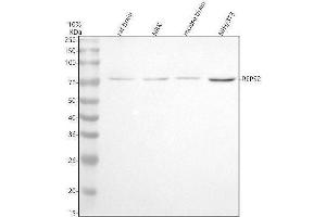 Western blot analysis of REPS2 using anti-REPS2 antibody (ABIN7602431).