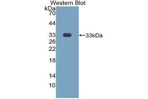 Western Blotting (WB) image for anti-Neuronal Pentraxin II (NPTX2) antibody (ABIN1865403) (NPTX2 anticorps)